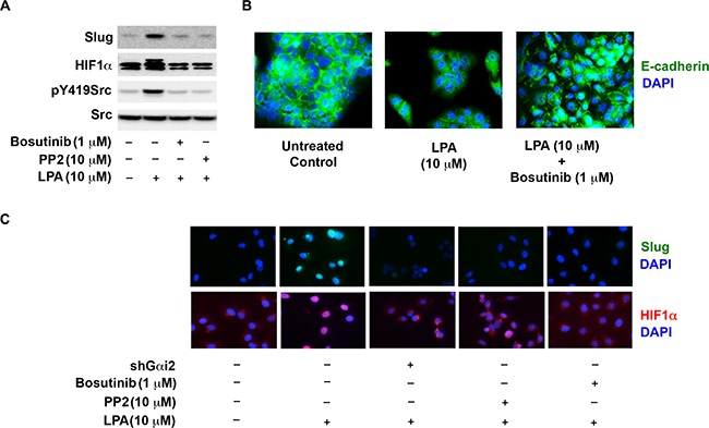 Src is required for the expression and activation of HiF1&#x03B1; and Slug.