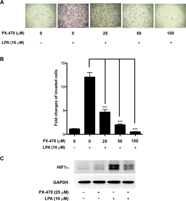 Inhibition of HIF1&#x03B1; attenuates LPA-induced invasive-migration of ovarian cancer cells.