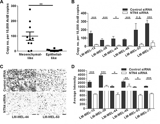 Targeting NTN4 results in loss of invasive potential of melanoma cells in vitro