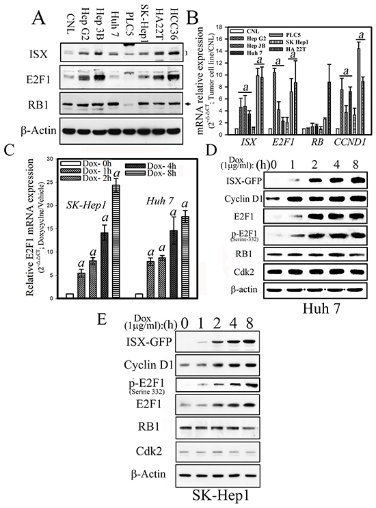 Forced ISX expression upregulates E2F1 in hepatoma cells.