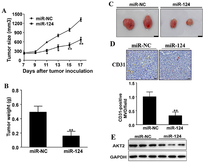 Overexpression of miR-124 inhibits tumor growth and angiogenesis.