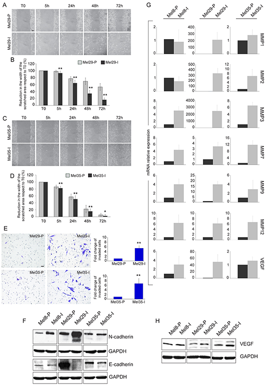 Migration and invasion assays and expression of invasive markers.