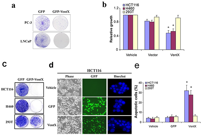 VentX suppresses the growth of human cancer cells and induces apoptosis.