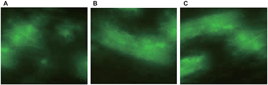 Fluorescence detection of 48h in myocardial cells transfected with virus.