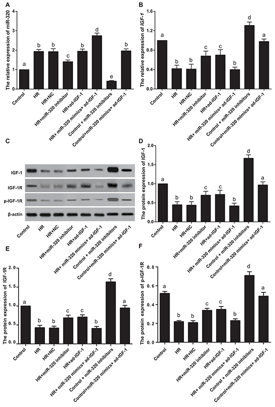 MiR-320 and IGF-1 mRNA and protein expressions in rat myocardial cells.