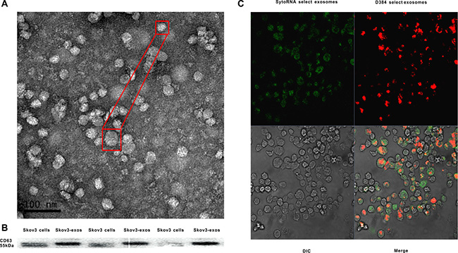 Identification of Skov3 secreted exosomes and internalization of the exosomes into recipient cells.