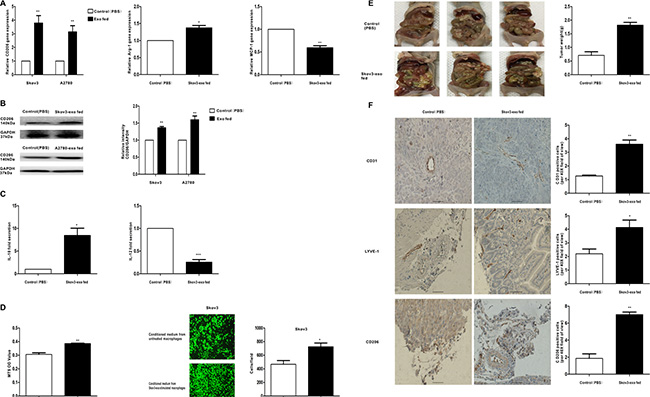 Exosomes derived EOC cells activate macrophages to a TAM-like phenotype in vitro and vivo, which can promote the progression of EOC.