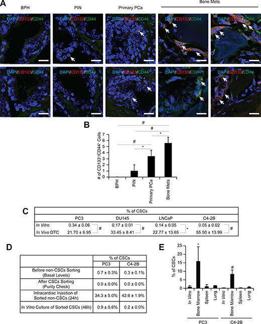 Enrichment of CSCs in disseminated prostate cancer.