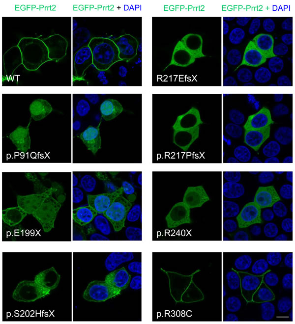 Subcellular localization of PKD-related PRRT2 mutations in cultured HEK293T cells.