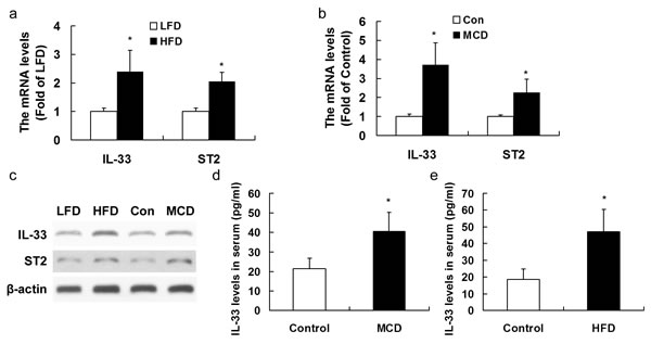 Mice were exposed to HFD for 20 weeks or MCD for 10 weeks to induce NASH.