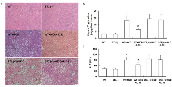 ST2 knockout mice and wild-type mice were fed with MCD, and treated with recombinant IL-33 for 10 weeks.