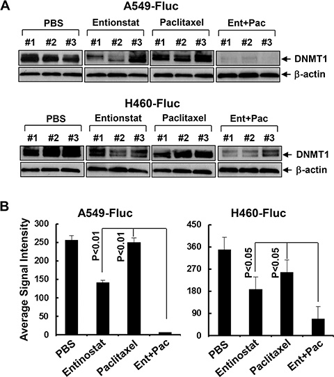 Entinostat reduces the expression of DNMT1 and its combination with paclitaxel exerts more potent inhibitory effects on DNMT1 in vivo.