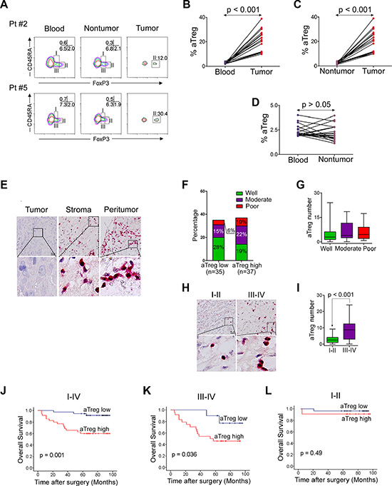 Phenotype and clinical implications of tumor-infiltrating Treg cells.