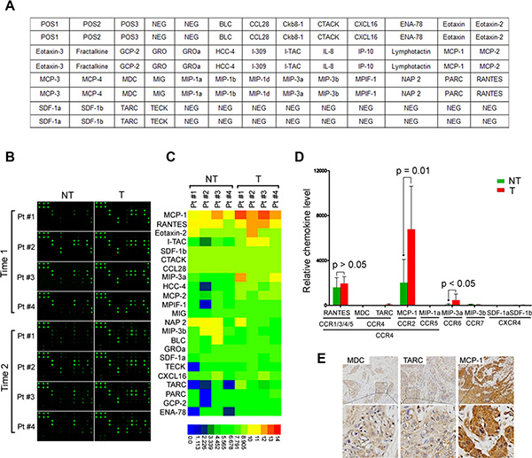 MCP-1 is increased in tumor tissues from HNSCC patients.