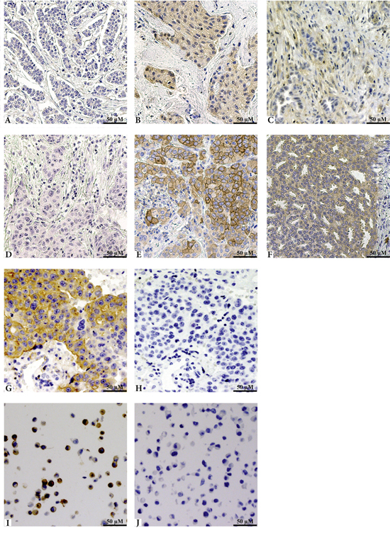 Representative images of IHC staining of HGF, pMet and the phospho-specific antibody validation.