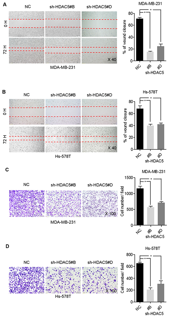 HDAC5 deficiency impedes BC cell migration and invasion.