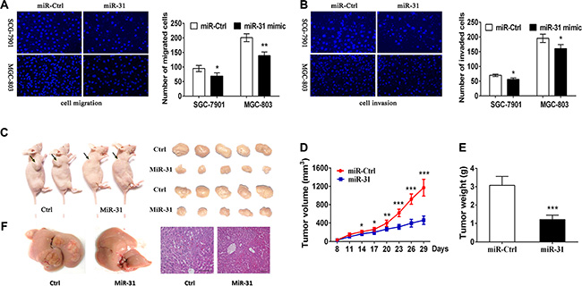 Suppression of gastric cancer cell migration and invasion and nude mouse xenograft formation and growth after restoration of miR-31 expression.