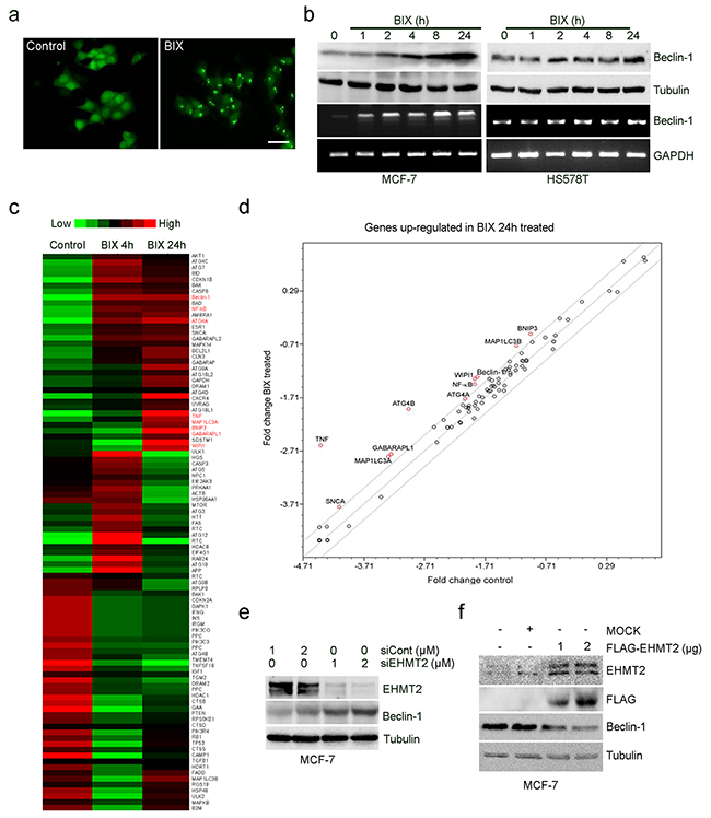 Inhibition of EHMT2 increases Beclin-1 expression.