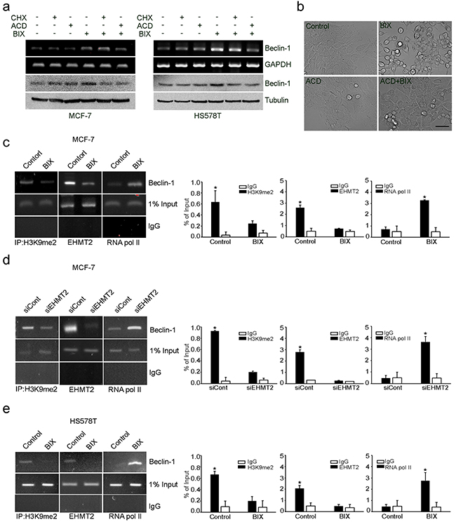 Epigenetic transcriptional activation of Beclin-1 by EHMT2 inhibition.