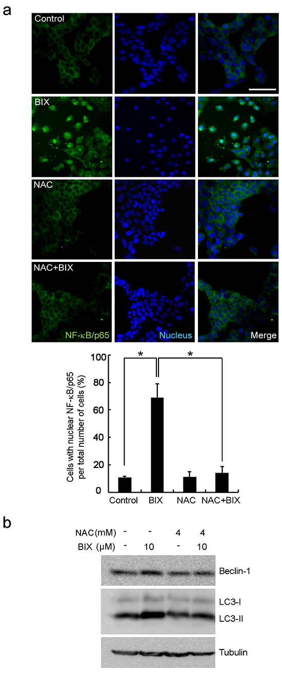 Intracellular ROS-mediated activation of autophagy in response to EHMT2 inhibition.