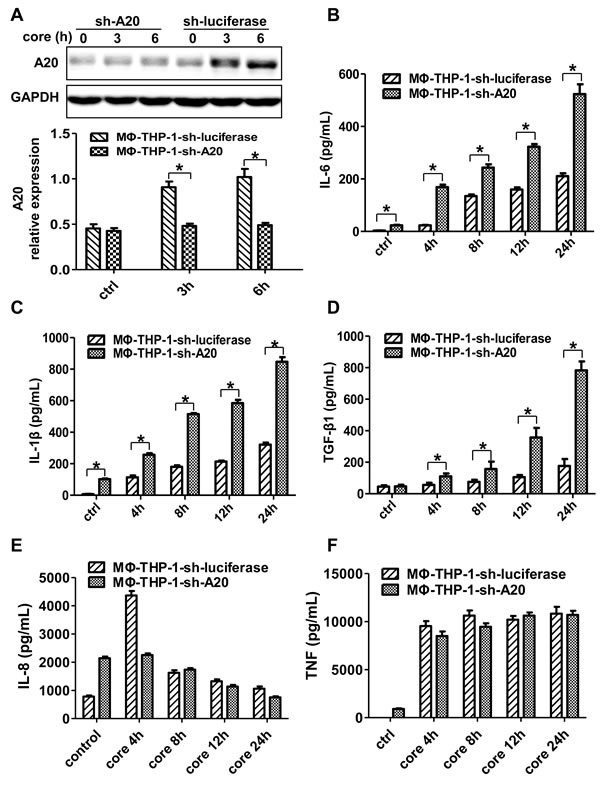 A20 negatively regulates the IL-6, IL-1&#x3b2; and TGF-&#x3b2;1 production.