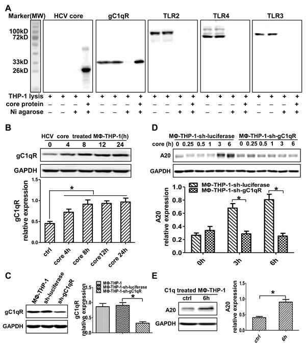 HCV core protein interacting with gC1qR induces A20 expression.