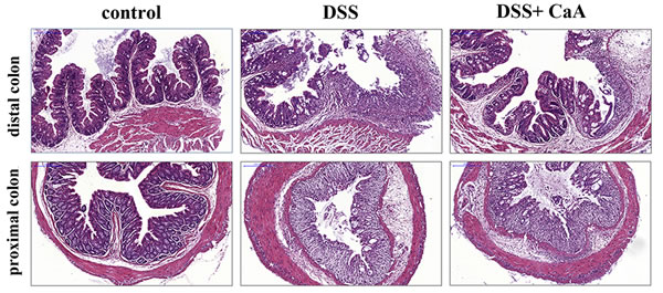 Effects of CaA on the histopathological characterization in DSS-induced mouse colitis.