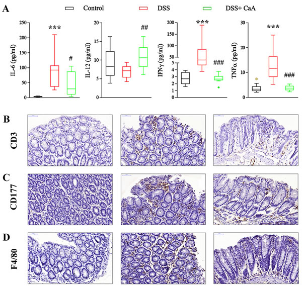 Effects of CaA on serum cytokines and colonic infiltration of inflammatory cells in DSS-colitis mice.