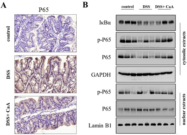 Effects of CaA on NF-&#x3ba;B signaling in DSS-treated mice.