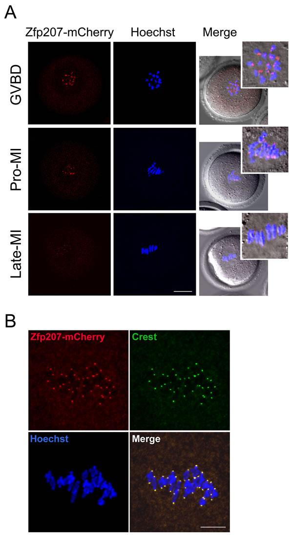 Localization of Zfp207 during mouse meiotic maturation.