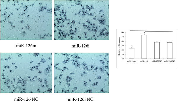Representative photos and statistical plots of transwell assays in SLK cells transfected with miR-126-3p mimics, miR-126-3p NC, miR-126-3p inhibitor and inhibitor negative control.