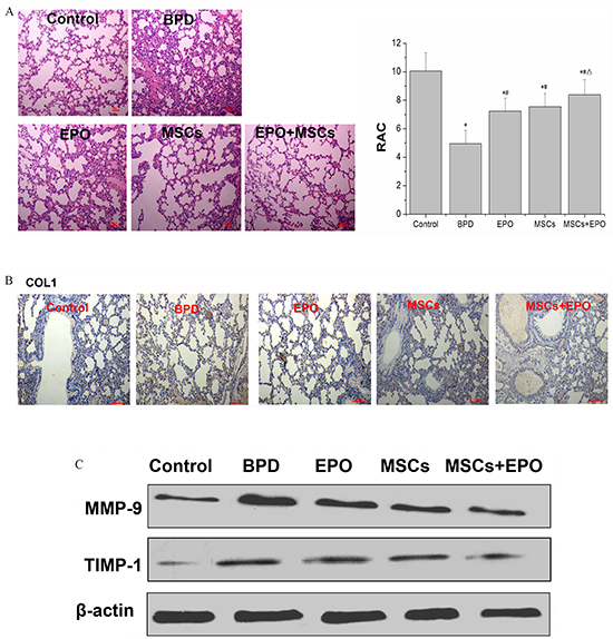 Hyperoxia impairs lung structure and fibrosis in neonatal mice.