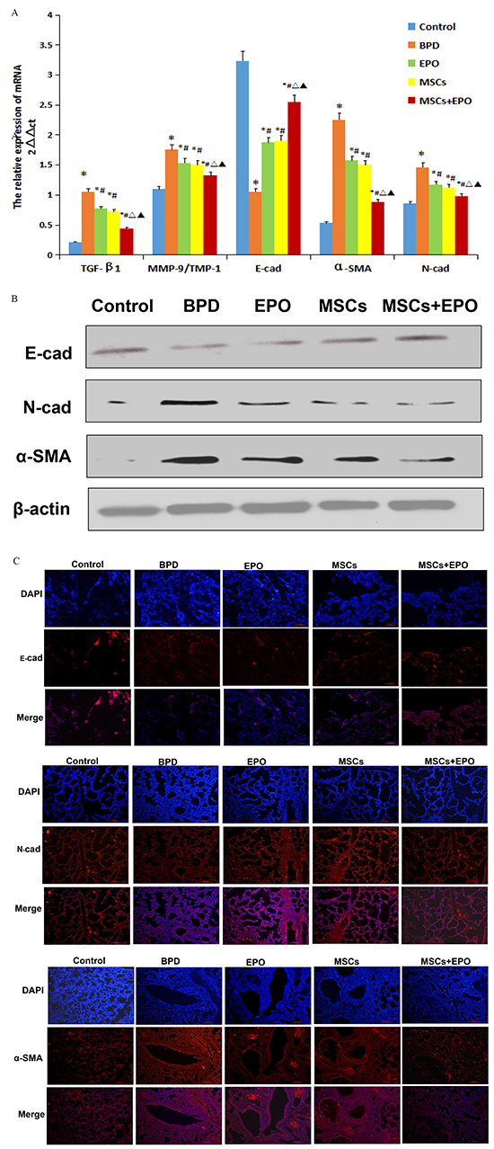 Effect of MSCs, EPO and MSCs+EPO on EMT markers in lung tissue.