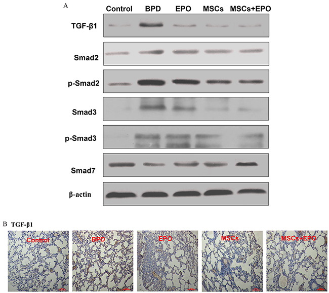 Effect of MSCs, EPO and MSCs+EPO on TGF-&#x03B2;1 signal pathway in lung tissue.