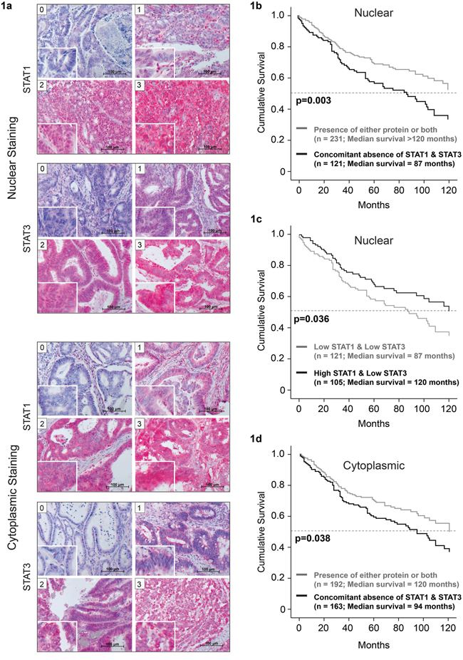 Lower median survival in patients with concomitant absence of nuclear STAT1 and STAT3.