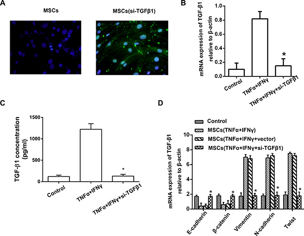 TGF-&#x03B2;1 knockdown of MSCs reverses the EMT in pancreatic adenocarcinoma cells.