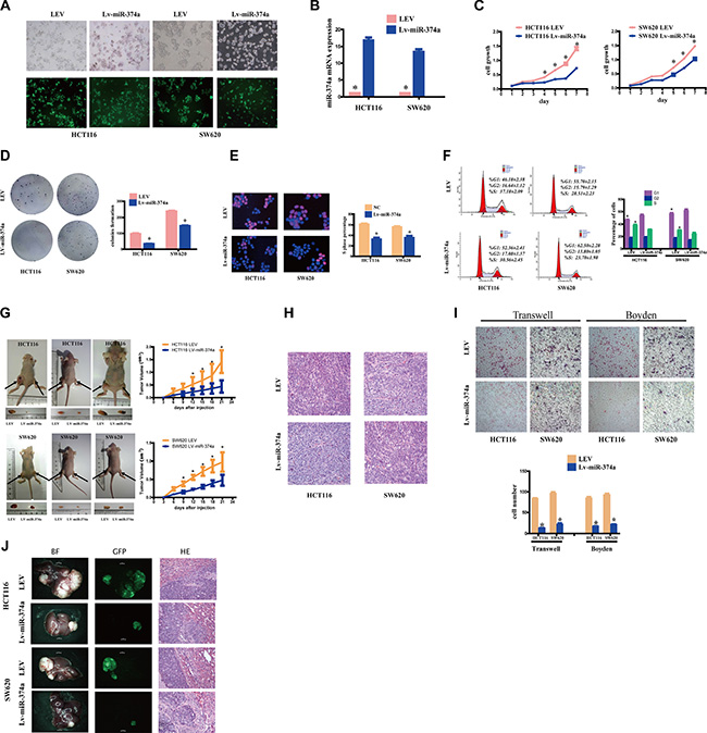 miR-374a overexpresssion inhibits proliferation, invasion and migration in vitro and in vivo.