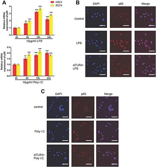 LPS and poly (I:C) induce HIF-1&#x03B1; and VEGF expression via the TLR-NF-&#x03BA;B pathway in OSCC.