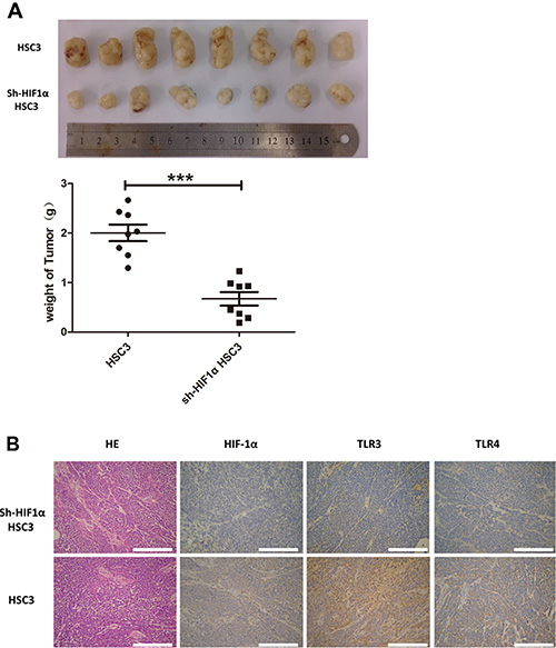 In vivo study of human OSCC using a transplantation model in nude mice.