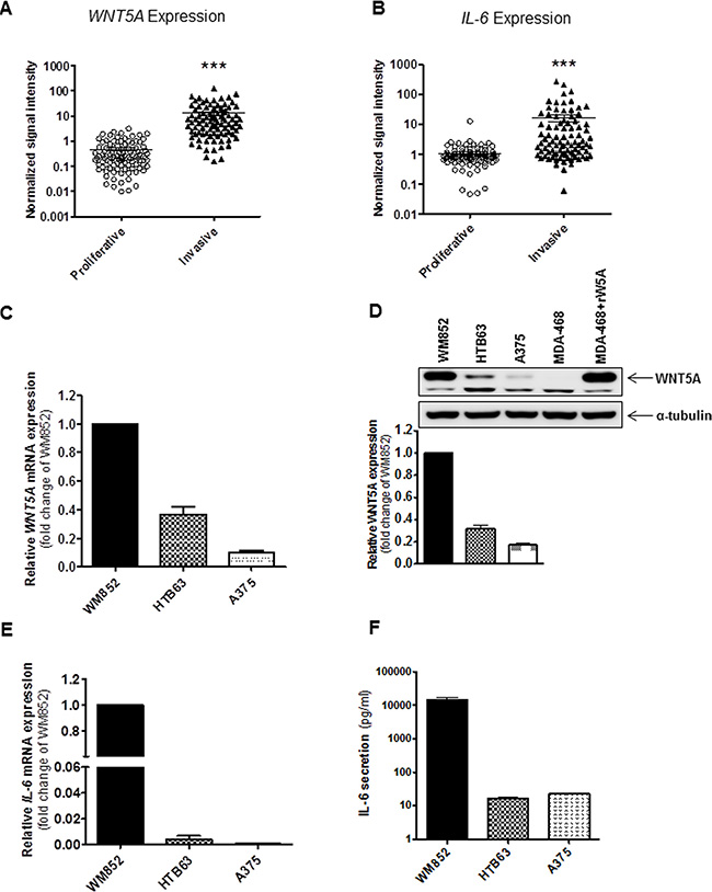 Increased expression of WNT5A and IL-6 is associated with an invasive melanoma cell phenotype.