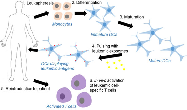 Process of dendritic cell-based leukemia immunotherapy using leukemia cell-derived exosomes as the source of antigens.