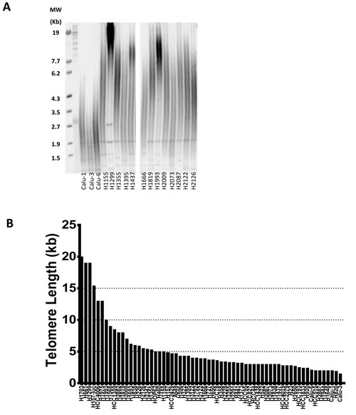 Heterogeneity of telomere length in NSCLC.