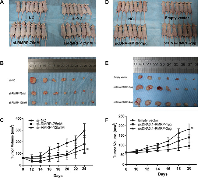 RMRP affects the growth and tumorigenicity of gastric cancer cells in vivo