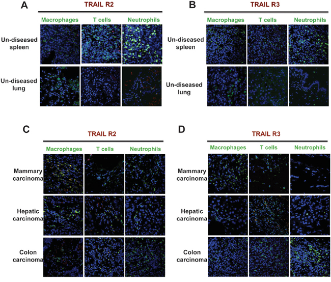 Human tumor-associated macrophages express TRAIL-R2.