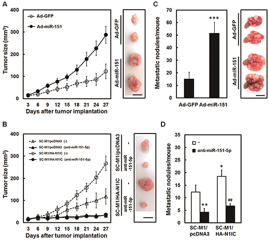 N1IC promoted tumor growth and lung metastasis of SC-M1 cells through miR-151-5p in vivo.