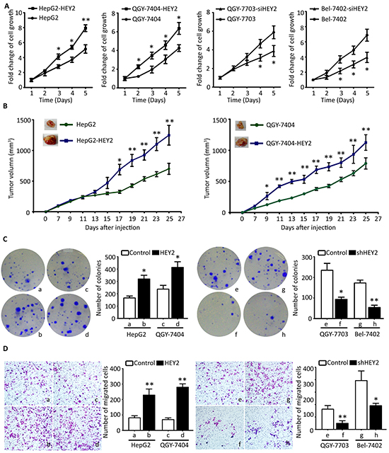 HEY2 promotes cell proliferation and migration in HCC cells.