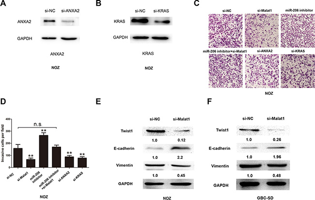 Cell invasion decreases after silencing Malat1/KRAS or ANXA2 signaling.