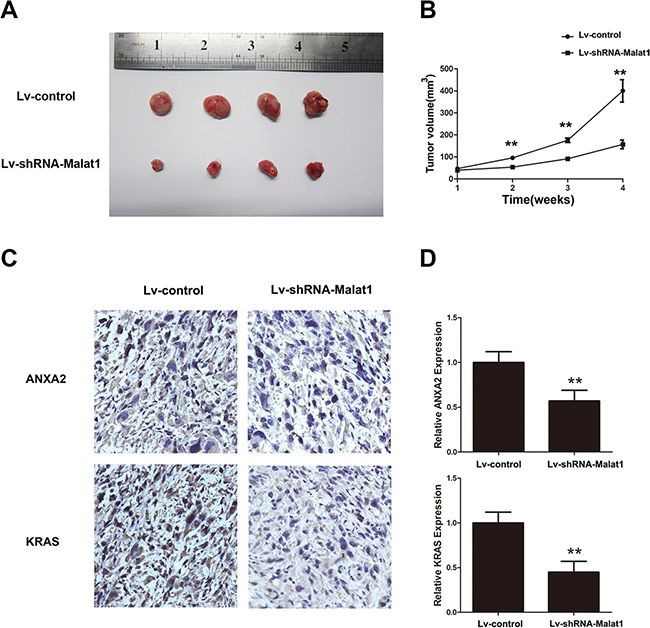 Malat1 promotes tumor growth in vivo.