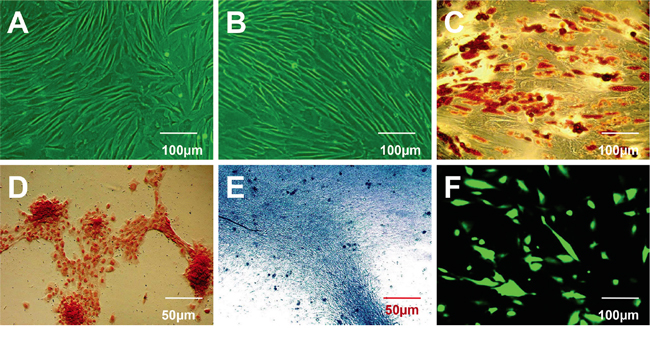 Characterization of human breast adipose-derived stem cells (HBASCs) prior to and following induction of multilineage differentiation.