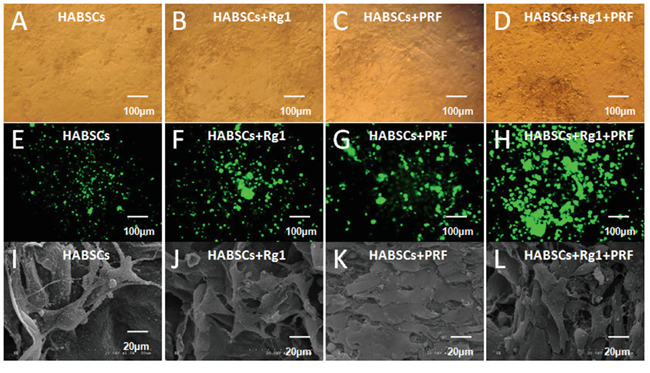 The morphology and status of HBASCs after co-culture with COL-S: